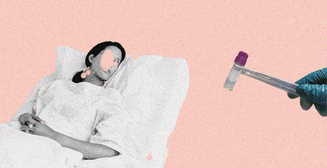 egg freezing